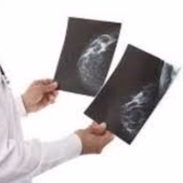 ¿Qué hace un lic en bioimagenes?